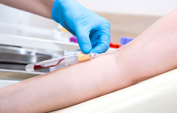 Le diverse tipologie di accesso vascolare: classificazione, indicazioni e gestione clinica
