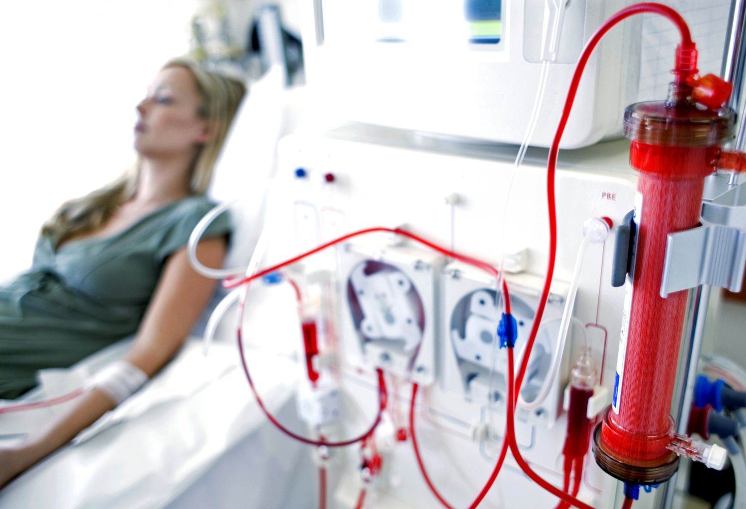 Il paziente dializzato e l’attenzione degli accessi vascolari in emodialisi